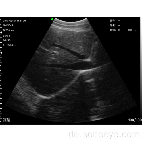 Mini Convex Ultraschallsonde